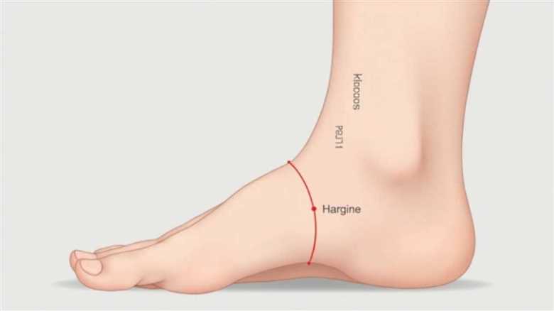 Bunion Correction: Effective Bunionectomy Techniques for Pain Relief and Optimal Foot Alignment